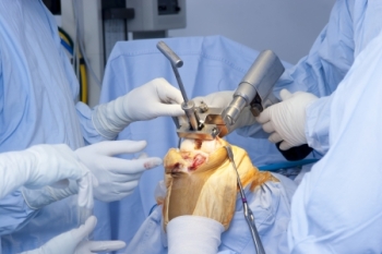 Knee Replacement Surgery